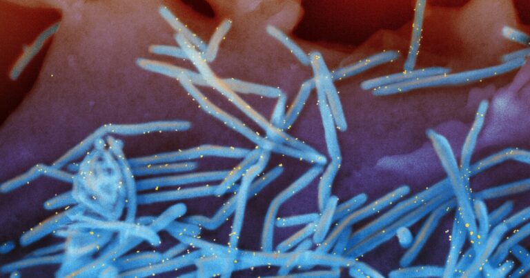의사들은 아기를 보호하기 위한 RSV 주사에 대한 FDA의 조사에 대해 우려하고 있습니다.
    


